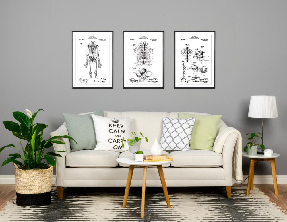 Szabadalmi rajz - Anatómiai csontváz III Poszter